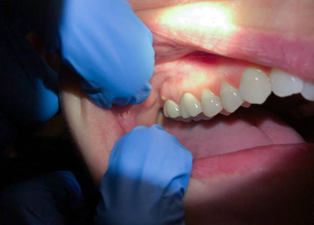 Best Tooth Infection Emergency Dentist  in Medford, MA